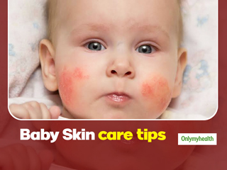  How To Take Care Of Your New Born's Skin In Winters? Here Are Some Tips For Baby Skin Care 