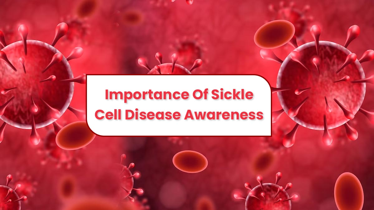 Sickle Cell Disease Awareness Month: Understanding Diagnosis, And Treatment