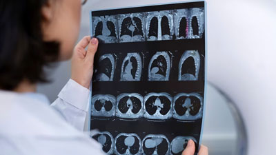 Bizarre Discovery: Punjab Man Undergoes Surgery to Remove Earphones, Lockets, and More from Stomach