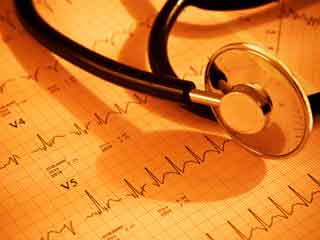 Experts Want You to Know These Atrial Fibrillation Facts