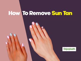 Get Rid Of Sunburn And Tan With Simple Home Remedies 