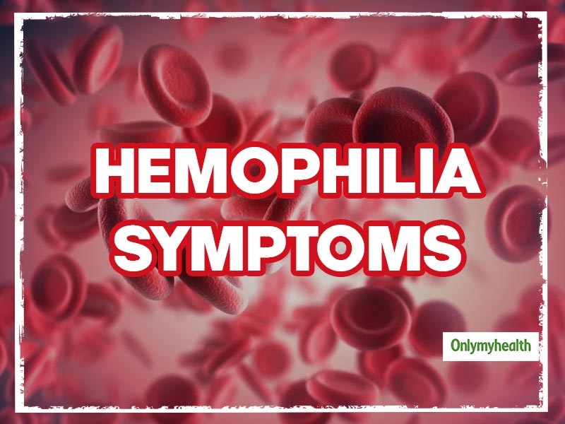 Hemophilia Symptoms: These 3 Conditions Could Be Possible Indicators Of Hemophilia