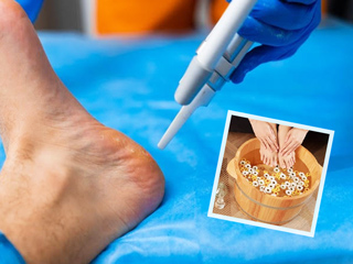 Follow These Expert Advised Dos And Don'ts For Diabetic Foot Care
