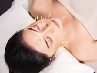  World Acupuncture Day 2021: 9 Astounding Benefits Of Acupuncture Therapy