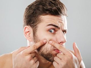 Try These 9 Effective Home Remedies To Get Rid Of Cystic Acne