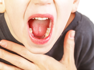 Do You Have A Swollen Uvula? Try These 9 Effective Home Remedies To Manage Uvulitis 