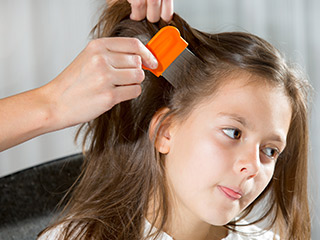 8 Home Remedies To Get Rid Of Head Lice Overnight