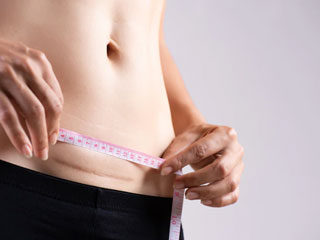 How To Take Care Of Yourself After Caesarean Birth, Doctor Verifies