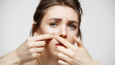 Troubled By Whiteheads? Follow These Tips To Deal With It