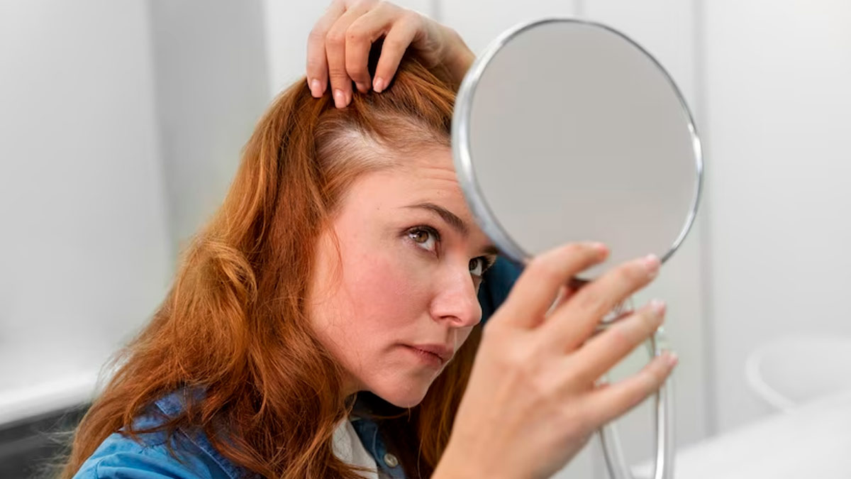 Monsoon Hair Care: 10 Tips To Treat Oily Scalp In Rainy Season