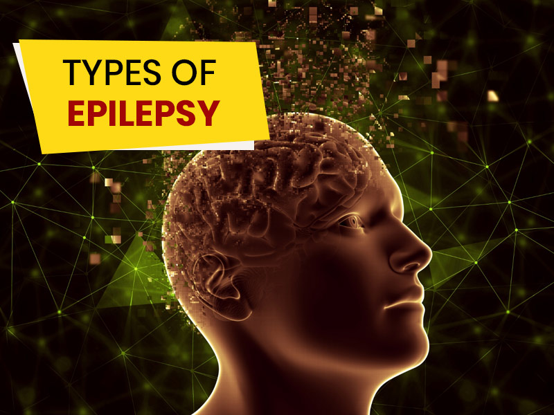 National Epilepsy Day 2023: Understanding 5 Different Types of Seizures
