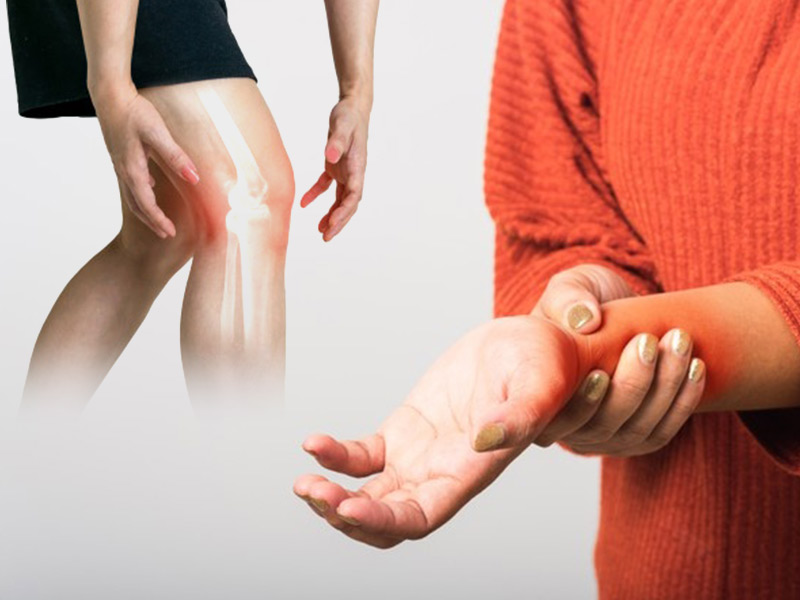 Winter Wellness: 6 Effective Strategies to Manage Arthritis