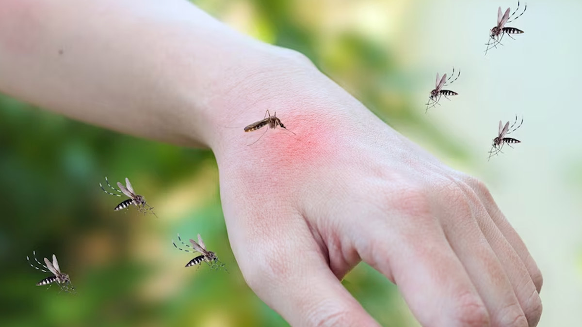 Ever Wondered Why Mosquitoes Seem to Prefer Some People? Mystery Behind Mosquito Attraction Busted