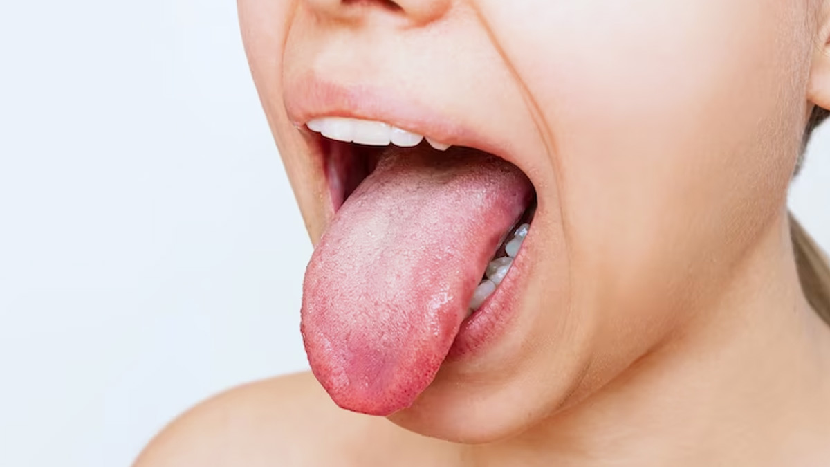 Secrets of Tongue Color: What Your Tongue Tells You About Your Health