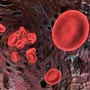 What are the causes of Anemia?