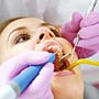 Before and After Tooth Extraction