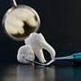 Information on Dental Implants