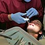 Myths About Root Canal Treatment