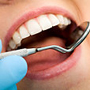 What happens during a Dental Checkup?
