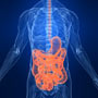 What is Celiac Disease?
