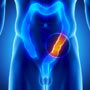 Types of Surgery for Prostate Cancer