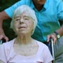 Stages of Alzheimer's Disease