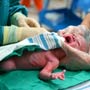 How a Caesarean Section is Done
