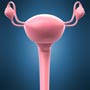 Stages of Cervical Cancer