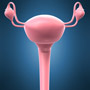 Facts about Cervical Cancer