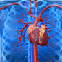 Pre-Diabetes Linked to Stroke Risk