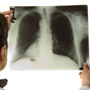 Stages of Lung Cancer