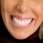 For a Smile Without Gum Show