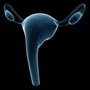 Tips to Prevent Ovarian cancer
