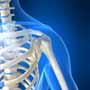 How is Bone Marrow Transplant done?