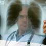 What are the Risks Associated with X-Rays?