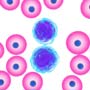 How to Prevent Multiple Myeloma?