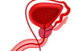 What is the treatment of Interstitial Cystitis?