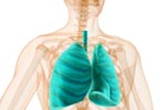 What is the diagnosis of Small Cell Lung Cancer?