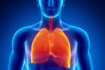 What is the treatment of Small Cell Lung Cancer?
