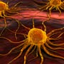 Unusual Cancer Facts