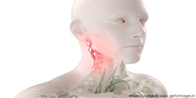 early stage swollen lymph nodes in neck cancer