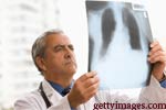 Treatment of Secondary Bone Cancer