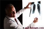 What does Stage 2 of Bone Cancer Mean?
