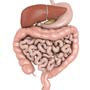 What is Colorectal Cancer?
