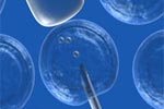 Two New Bowel Cancer Genes Discovered