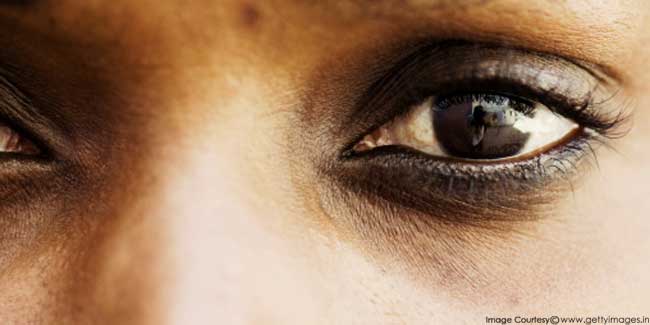 6 Tips on How to Get Rid of Dark Under Eye Circles
