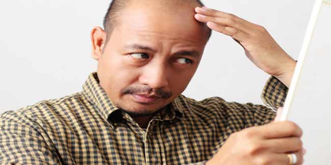 Stages of Male Female Pattern Baldness | Hair Loss