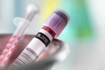 Quick and Easy Blood Test to Diagnose Cancer and its Stage