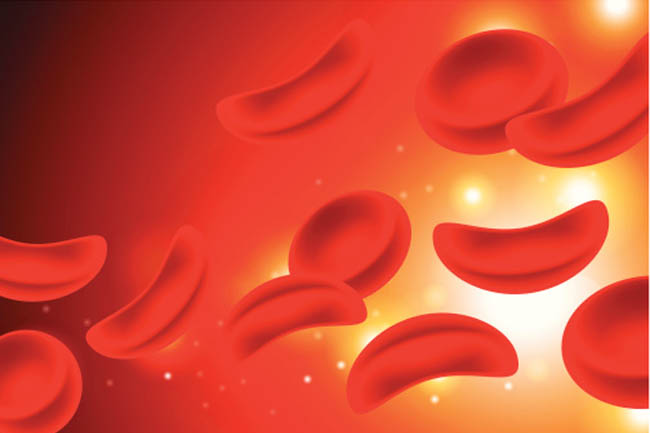Myths associated with Blood Clots