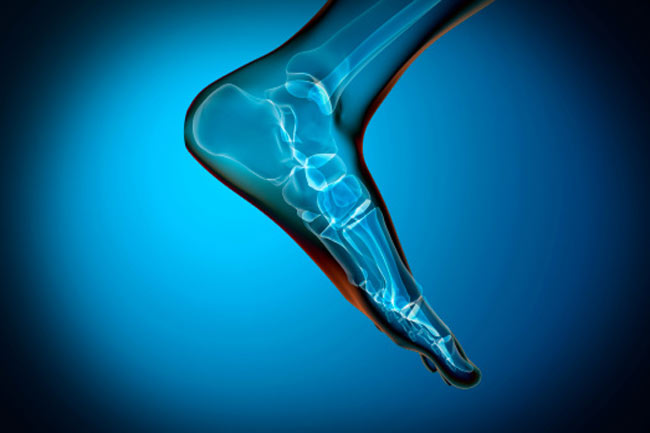 परीधीय धमनी रोग (Peripheral Artery Disease)